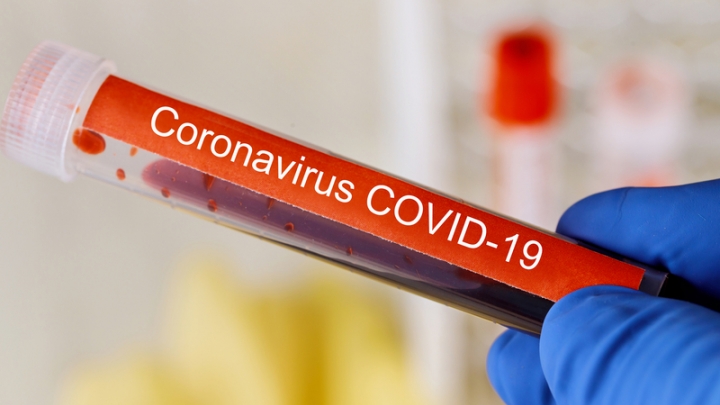 Mysterious Syndrome May Be Tied to COVID-19